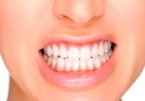Diş Sıkma Nedir
