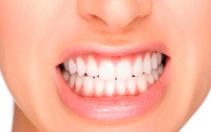 Diş Sıkma Nedir