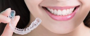 İnvisalign