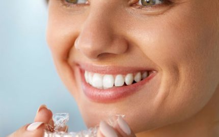 invisalign tedavisi nedir