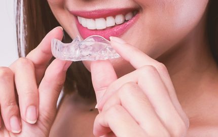 Şeffaf Plaklar ile Invisalign Tedavisi
