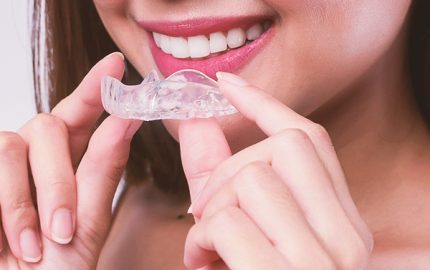 Şeffaf Plaklar ile Invisalign Tedavisi